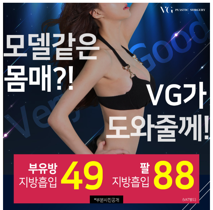 부유방, 팔 지방흡입 베리굿성형외과에서 모델같은 몸매! 관련 이미지 1