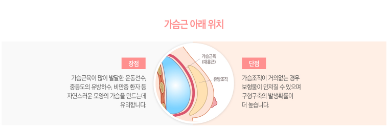 가슴성형 아름다운 라인을 위해 꼼꼼히 알아보자! 관련 이미지 9