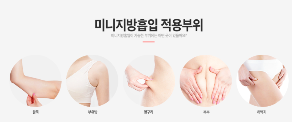 미니지방흡입으로 군살제거하고 당당하게! 관련 이미지 3
