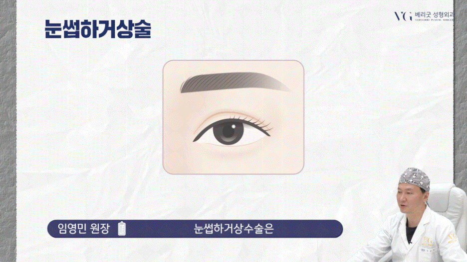 강남중년눈성형 잘하는곳 , 상안검 하안검 눈썹하거상술종류 진행방법 궁금하다면 관련 이미지 21
