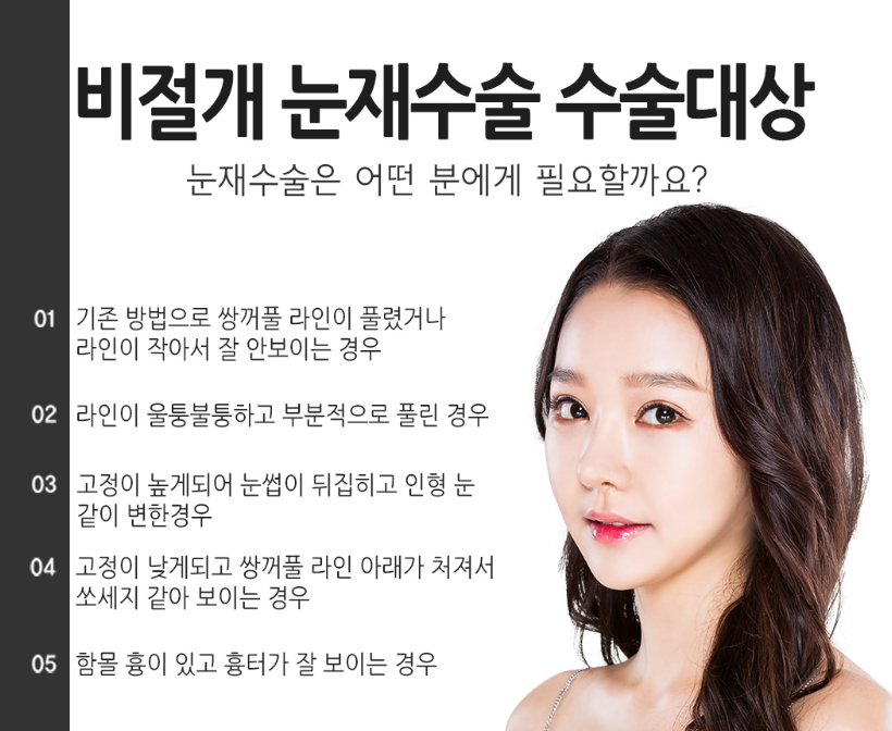 눈재수술 전문, 베리굿성형외과 임영민 원장님 관련 이미지 3