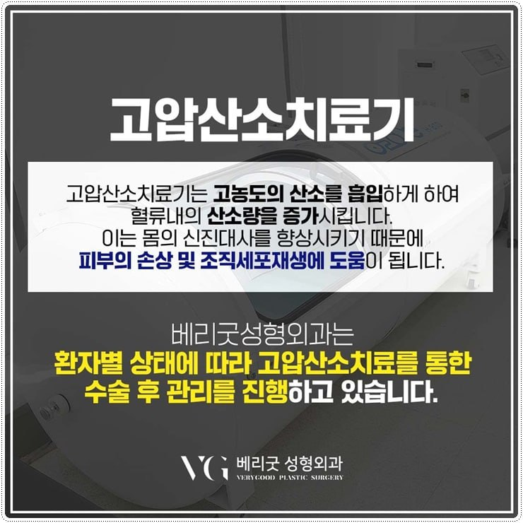 성형수술 후 염증, 붓기, 멍 개선에 도움주는 고압산소치료 효과 , 베리굿성형외과 관련 이미지 6