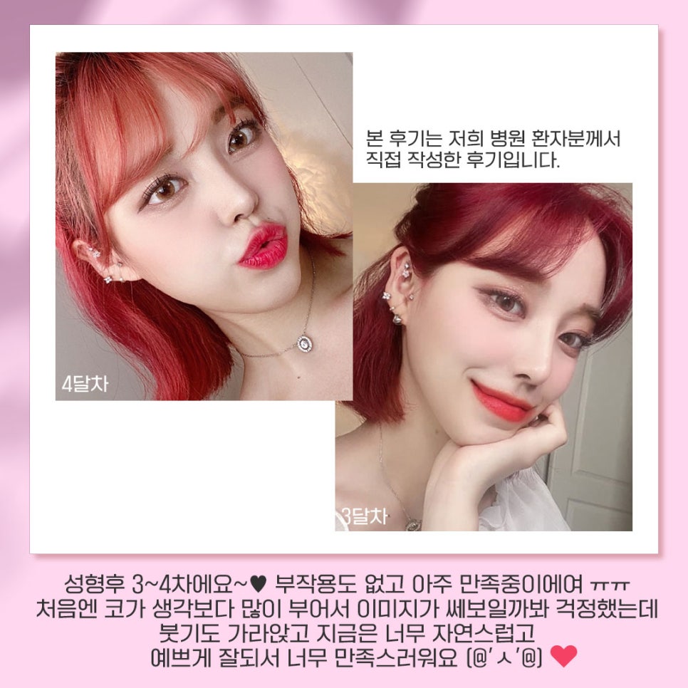 베리굿성형외과가 추천하는 성형별 추천👏 관련 이미지 11