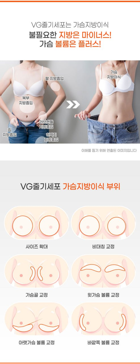 빈약한 가슴 때문에 가슴지방이식, 가슴수술 고민하고 있다면 ? 강남역가슴성형병원 관련 이미지 7