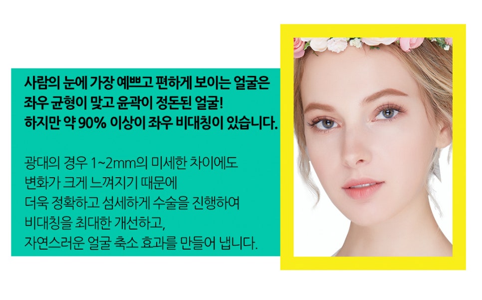 얼굴 작아지는법/ 베리굿성외과 3D광대축소술180만원 /강남역성형외과/강남역위치 관련 이미지 3