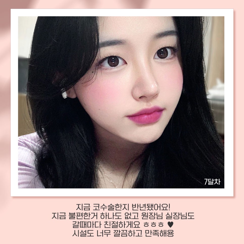 베리굿성형외과가 추천하는 성형별 추천👏 관련 이미지 5