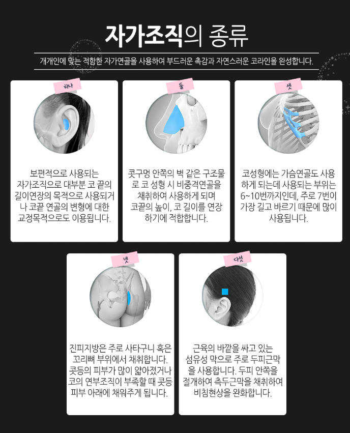 베리굿성형외과, 엑설런트 코성형! 임영민원장님의 노하우! 관련 이미지 5