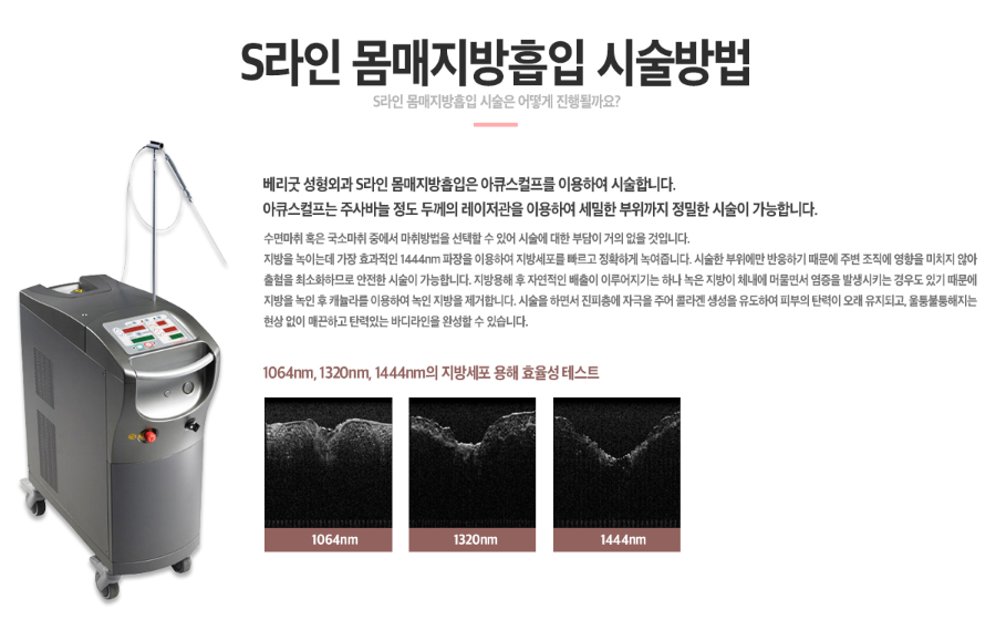 탄탄하고 슬림한 몸매, 지방흡입술로 만족스럽게! 관련 이미지 3