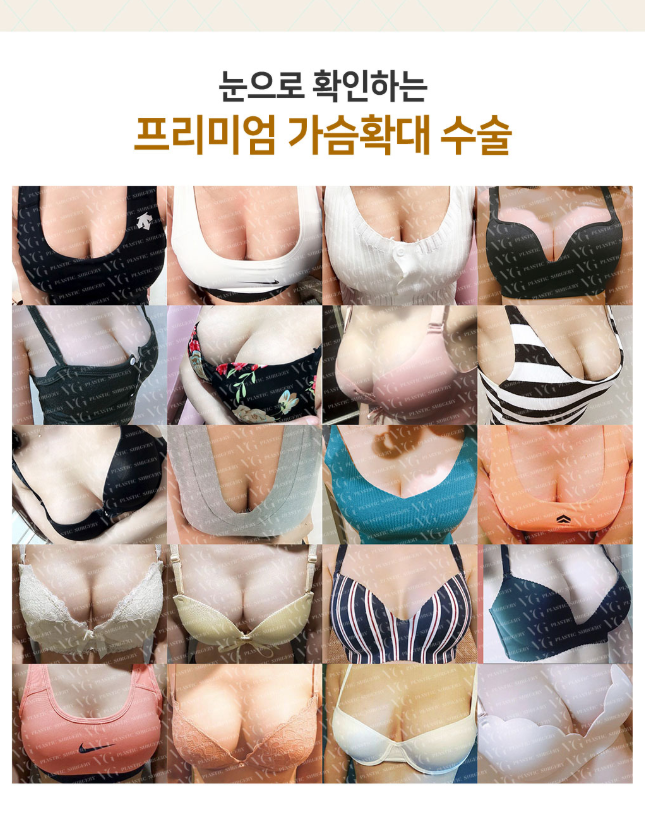 베리굿성형외과 프리미엄 가슴확대! 임영민원장님 기대해봐요! 관련 이미지 10