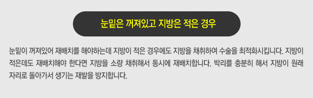 눈밑지방재배치 하고 환한 쌩얼로 자신있게! 관련 이미지 5