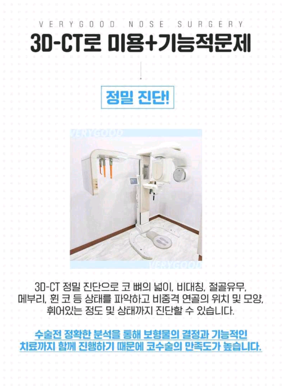 베리굿성형외과-MZ코,내돈 내산 코성형후기 mz세대의 유행하는 코성형은? 코성형부작용 1일차,3일차,1달차,전후후기 관련 이미지 10