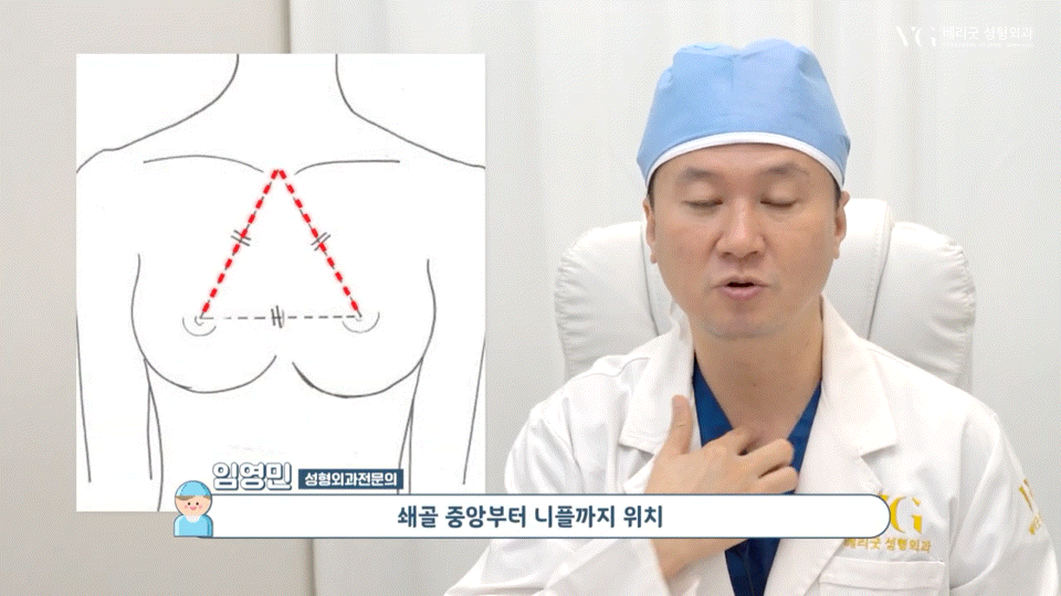 강남역가슴성형 절개법 절개부위 , 체형별 적합한 다양한 절개방법 장단점 총정리 관련 이미지 7