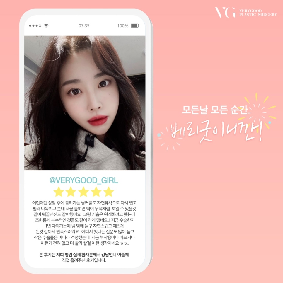 안면윤곽비용 , 비용만 생각해선 안돼 관련 이미지 8