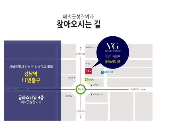 눈밑지방제거, 칙칙하고 그늘진 눈밑 베리굿성형외과에서! 관련 이미지 12