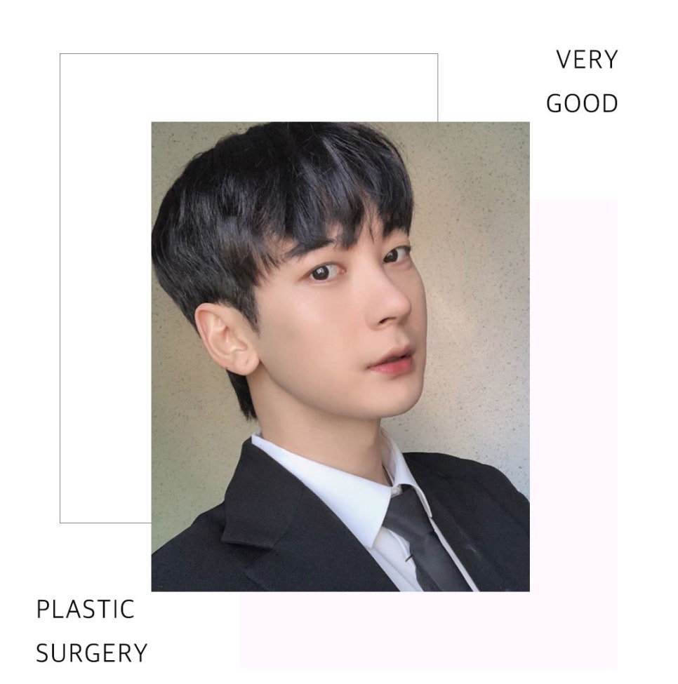 자연스러운 얼굴 라인~베리굿 남자 안면윤곽 관련 이미지 1