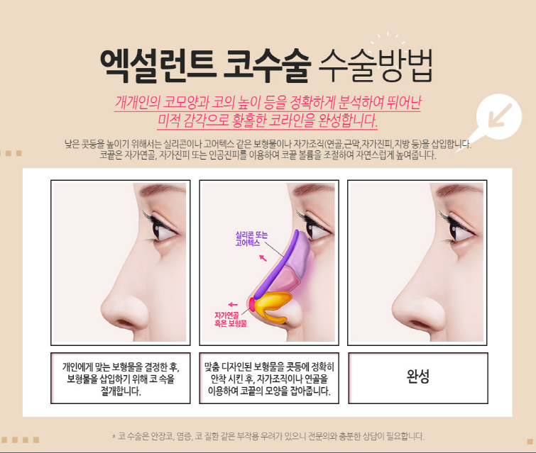 코성형 내게맞는 라인으로 관련 이미지 4