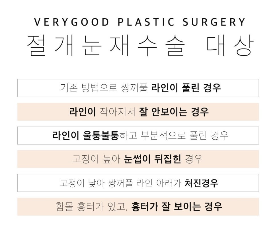마지막 눈재수술-실패없는 선택 관련 이미지 2