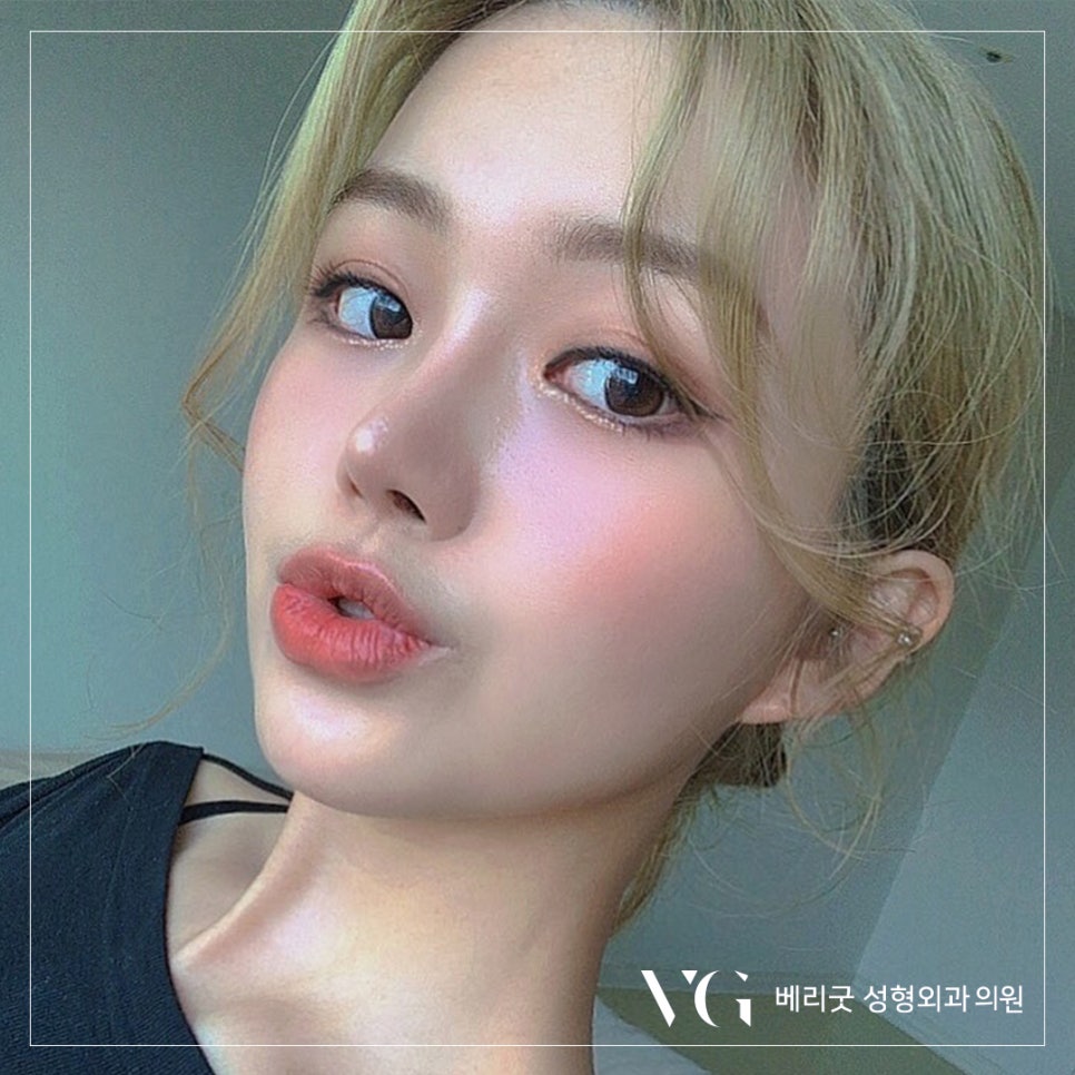 베리굿에서 자가늑연골로 베리굿하게 코수술하자💜 관련 이미지 1