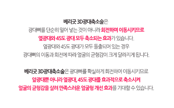 광대축소술 이젠 가리지말고 당당하게! 관련 이미지 5