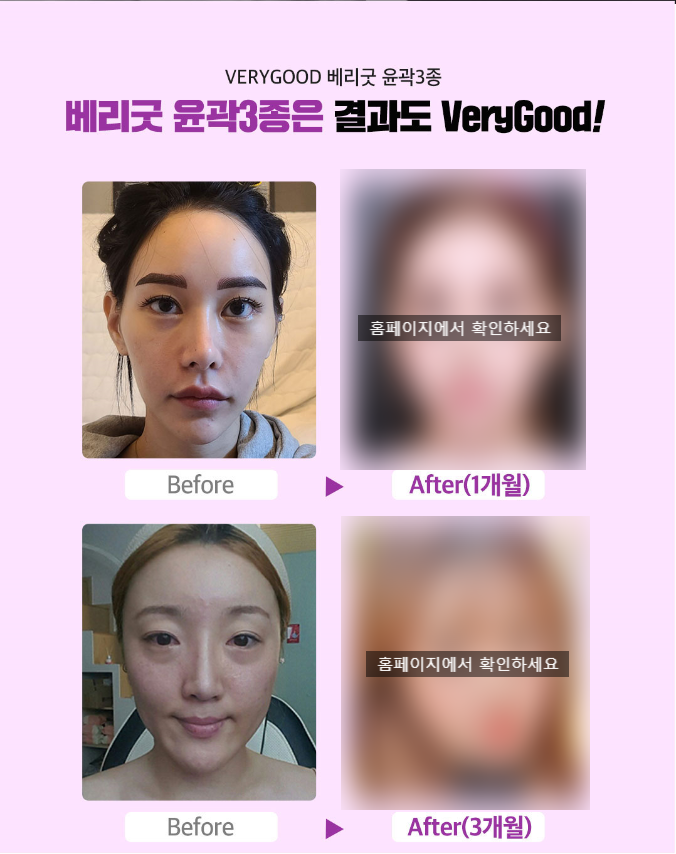 각진얼굴형 얼굴작아지는법 관련 이미지 7