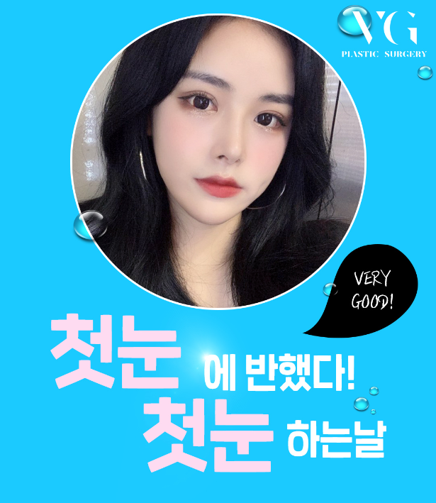 눈성형잘하는곳 내게 맞는 눈매라인에 맞게 관련 이미지 2