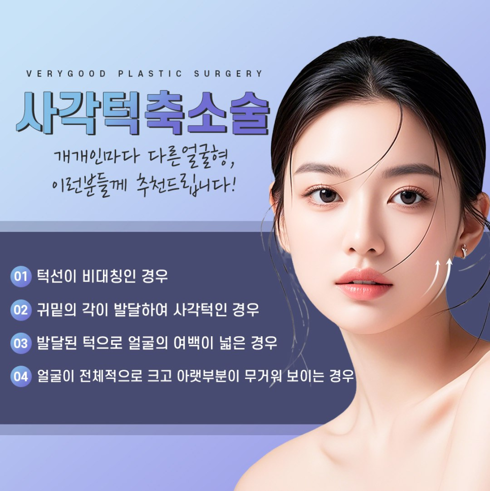 자연스러운 V라인 만드는 강남 사각턱축소술 , 3D-CT 분석으로 확인하는 윤곽 변화 관련 이미지 3