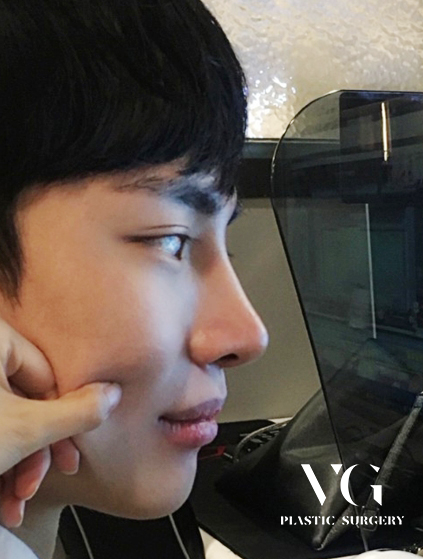 남자눈매교정전후 확실하게 관련 이미지 6