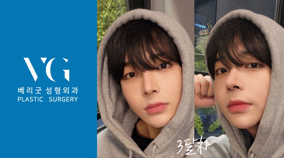 남자인생코 맛집 베리굿성형외과 리얼스토리💌 관련 이미지 5