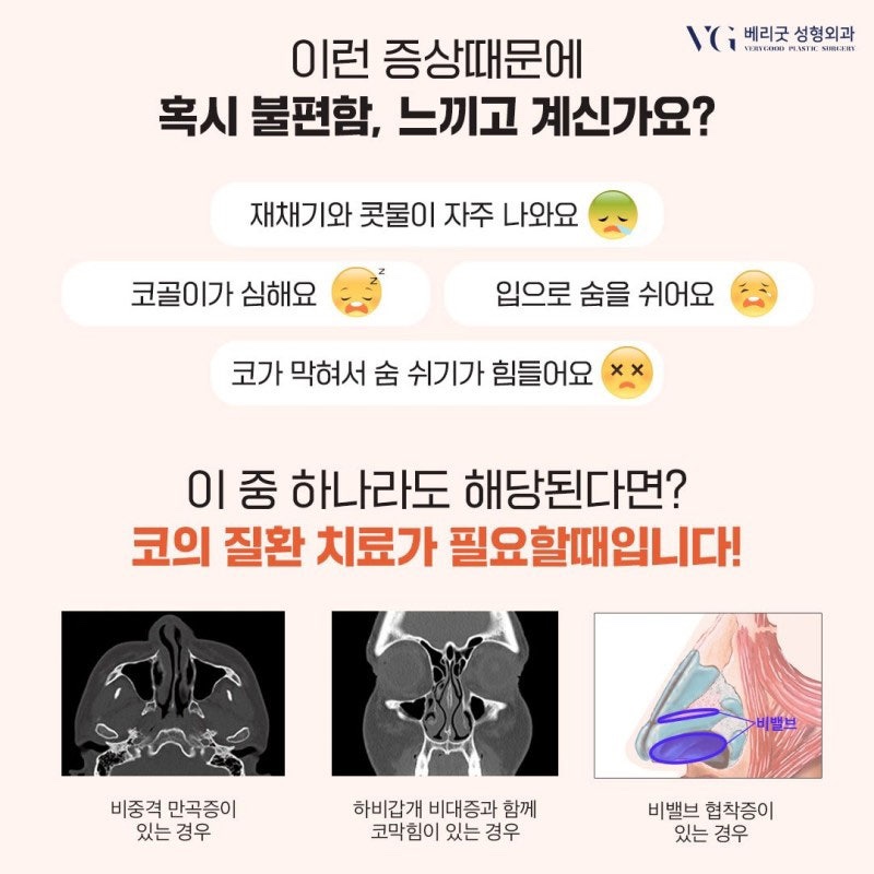 코재수술원인 부터 강남코재수술잘하는병원 , 코재수술실제후기 궁금하다면 관련 이미지 5