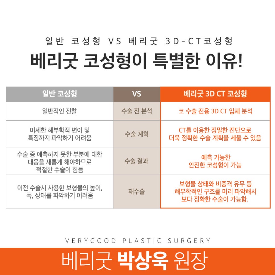 코성형 재료부터 비용까지 관련 이미지 3