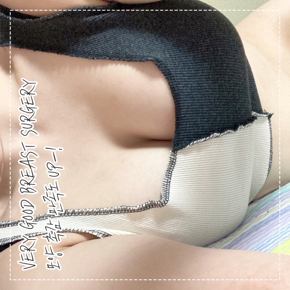 마른A컵도 가능🙈❤ 베리굿 성형외과의 베리굿 가슴성형✨ 관련 이미지 7
