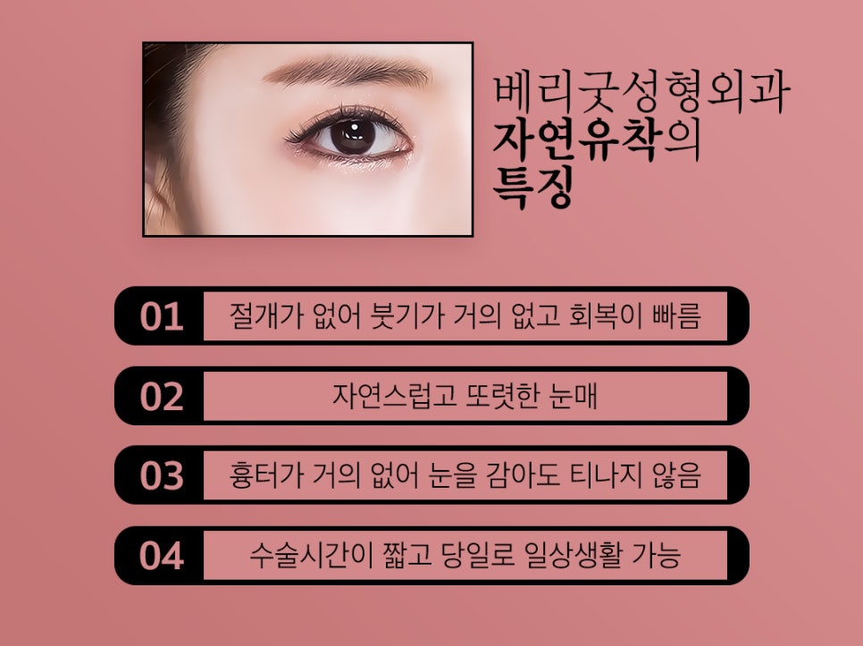 자연유착 쌍꺼풀수술, 마치 내 것 같은 자연스러움 관련 이미지 6