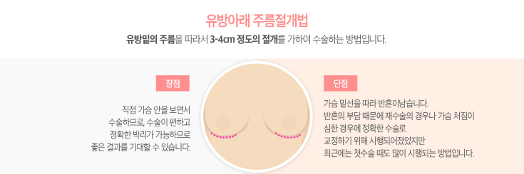 가슴성형 아름다운 라인을 위해 꼼꼼히 알아보자! 관련 이미지 7