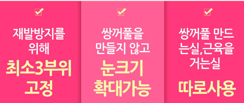 눈재수술 전문, 베리굿성형외과 임영민 원장님 관련 이미지 6