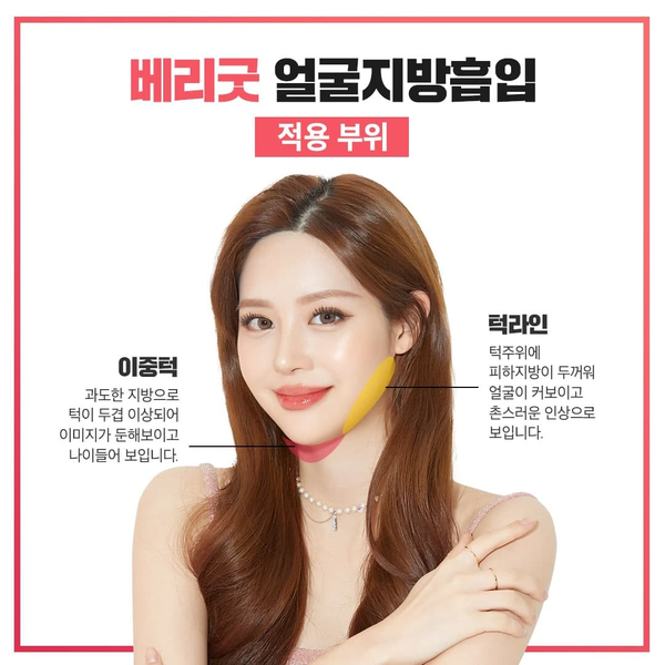 윤곽없이 v라인 얼굴지흡으로 완성! 관련 이미지 4