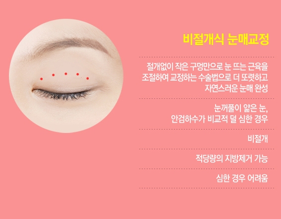 [베리굿성형외과 강남눈매교정]누구나 반하는 또렷한 눈매만들기✨ 관련 이미지 3