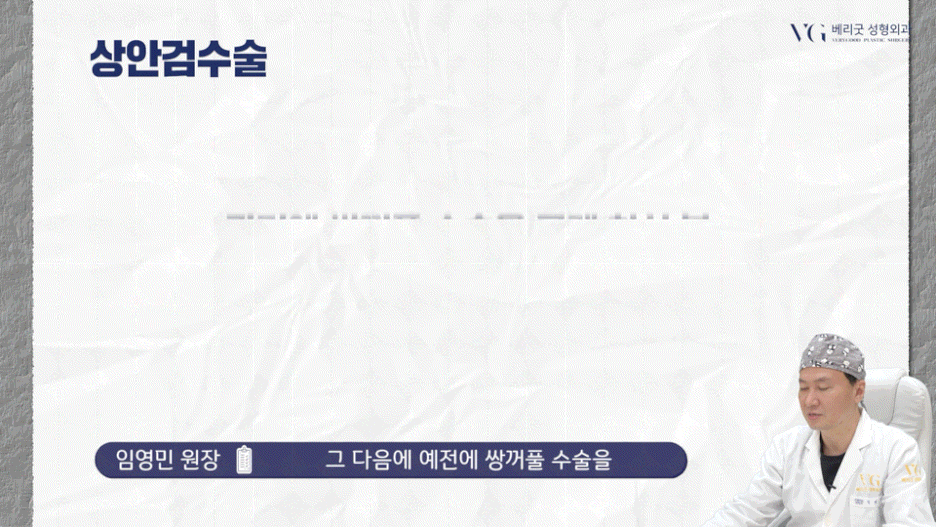 강남중년눈성형 잘하는곳 , 상안검 하안검 눈썹하거상술종류 진행방법 궁금하다면 관련 이미지 35