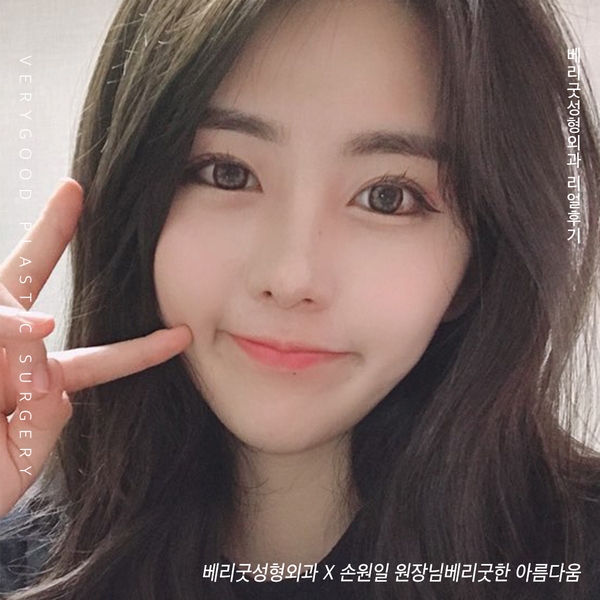 눈성형유명한곳 꼭! 알고 가야하는것? 관련 이미지 2