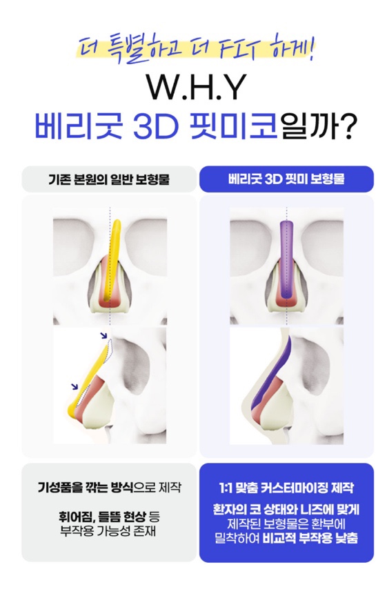 강남역 코재수술 , 나에게만 딱 맞는 3D 맞춤형 보형물으로 관련 이미지 4