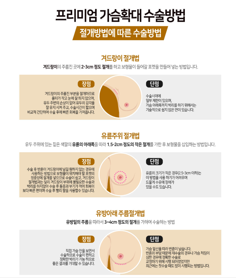 베리굿성형외과 프리미엄 가슴확대! 임영민원장님 기대해봐요! 관련 이미지 6
