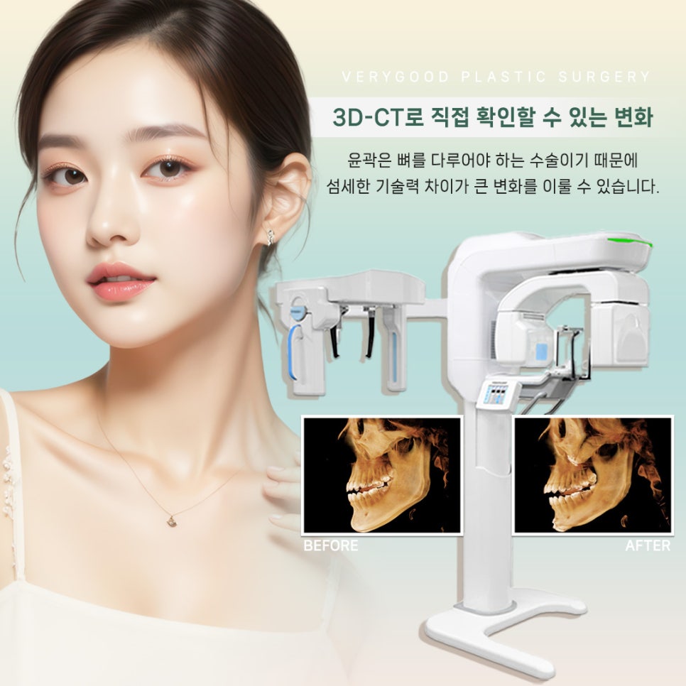 얼굴형 개선 고민 끝! 강남역 안면윤곽 3종으로 자연스러운 V라인 만드는 법 관련 이미지 4