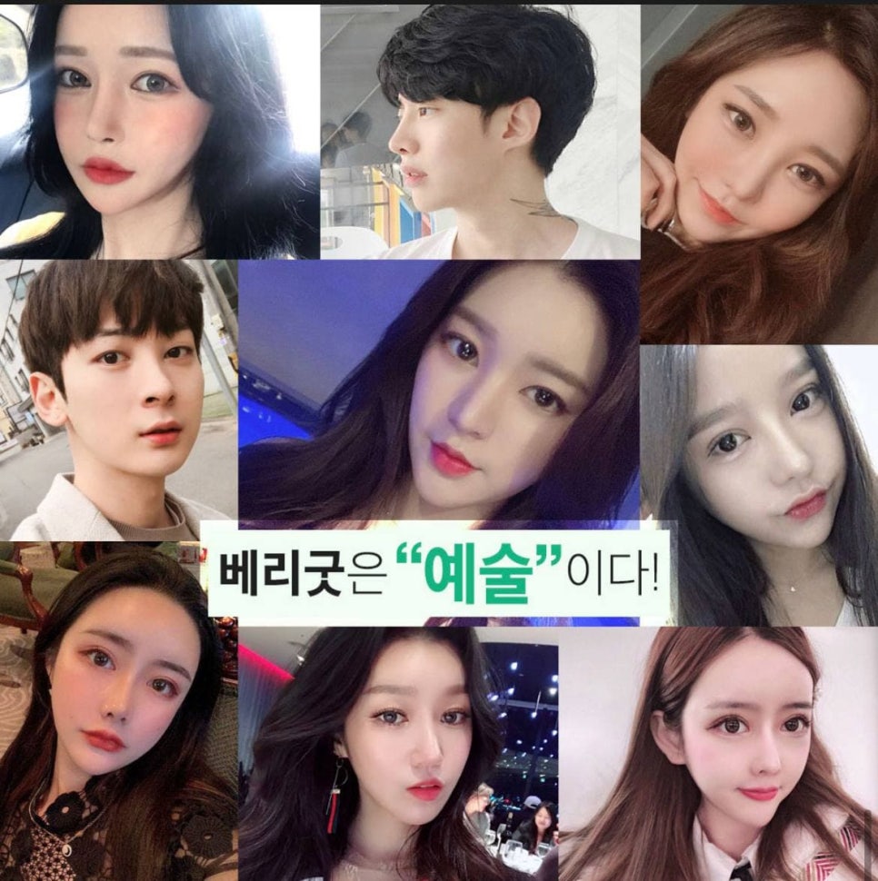 풀페이스 지방이식,지방이식 가격 알아보자 관련 이미지 7