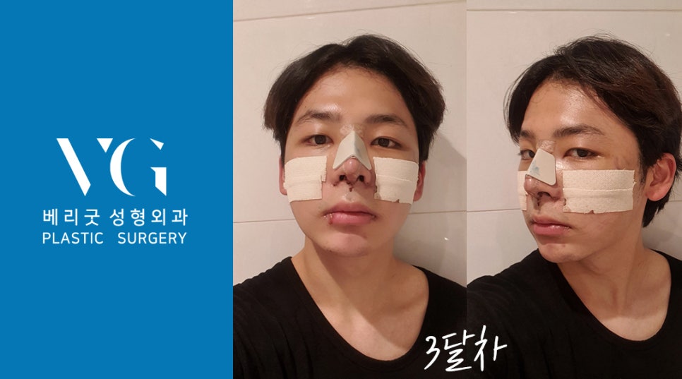 남자인생코 맛집 베리굿성형외과 리얼스토리💌 관련 이미지 2