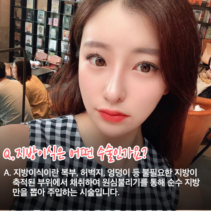 지방이식의 모든것이 궁금할때!! 베리굿이 알려줄게! 관련 이미지 4