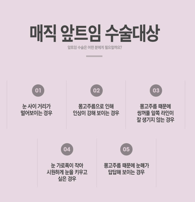 블링블링💖베리굿성형외과💖트임성형💖 관련 이미지 2