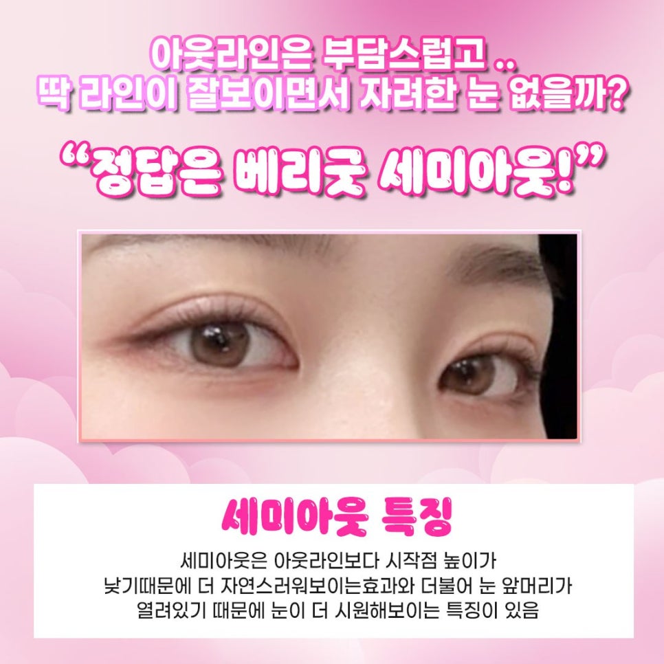 장원영 쌍커풀라인 세미아웃 눈성형 , 나한테도 어울릴까 관련 이미지 2