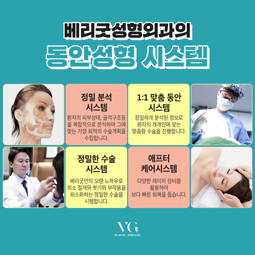 10년은 젊어보이는 동안성형 베리굿 애교하안검❣ 관련 이미지 7