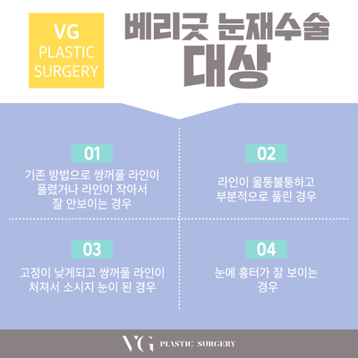 성공적인 눈재수술을 위한 포인트! 관련 이미지 3