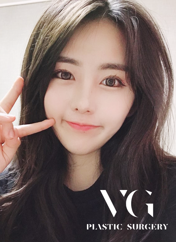 턱끝V라인으로 갸름한 얼굴라인 될수있다? 관련 이미지 1