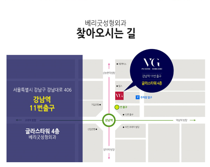 엑설런트코성형으로 콧대높은 자신감 얻자! 관련 이미지 16